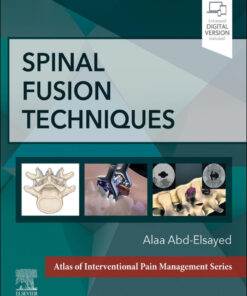 Spinal FusionTechniques