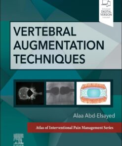 Vertebral Augmentation Techniques - 1st Edition