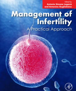 Management of Infertility - 1st Edition