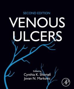 Venous Ulcers - 2nd Edition