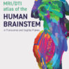 MRI/DTI Atlas of the Human Brainstem in Transverse and Sagittal Planes - Electronic - 1st Edition