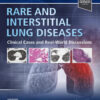 Rare and Interstitial Lung Diseases - 1st Edition