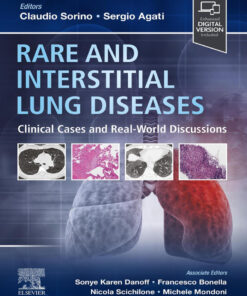 Rare and Interstitial Lung Diseases - 1st Edition