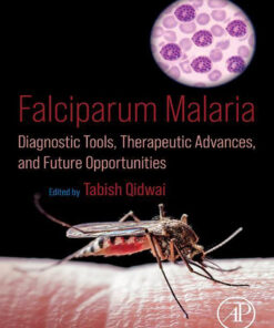 Falciparum Malaria - 1st Edition