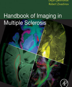 Handbook of Imaging in Multiple Sclerosis