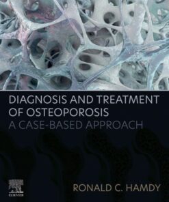 Diagnosis and Treatment of Osteoporosis - 1st Edition