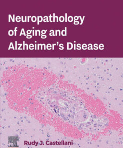 Neuropathology of Aging and Alzheimer’s Disease