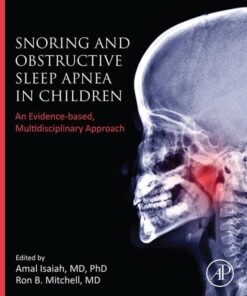 Snoring and Obstructive Sleep Apnea in Children - 1st Edition