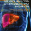 Safe Major Hepatectomy after Preoperative Liver Regeneration - 1st Edition