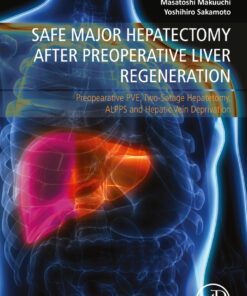 Safe Major Hepatectomy after Preoperative Liver Regeneration - 1st Edition