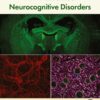 HIV-Associated Neurocognitive Disorders - 1st Edition
