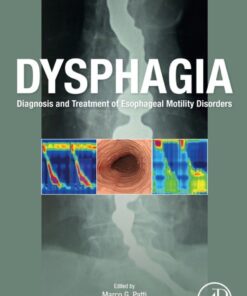 Dysphagia - 1st Edition