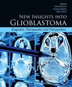 New Insights into Glioblastoma - 1st Edition
