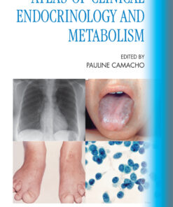 Atlas of Clinical Endocrinology and Metabolism - 1st Edition