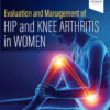 Evaluation and Management of Hip and Knee Arthritis in Women