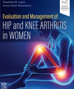 Evaluation and Management of Hip and Knee Arthritis in Women