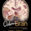 Osborn's Brain - 3rd Edition
