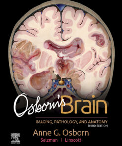 Osborn's Brain - 3rd Edition
