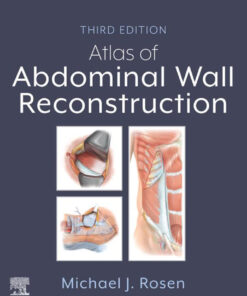 Atlas of Abdominal Wall Reconstruction - 3rd Edition