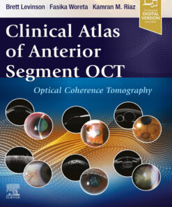 Clinical Atlas of Anterior Segment OCT: Ocular Coherence Tomography - 1st Edition