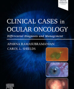 Clinical Cases in Ocular Oncology - 1st Edition