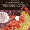 Pathophysiology and Treatment of Atherosclerotic Disease in Peripheral Arteries - 1st Edition
