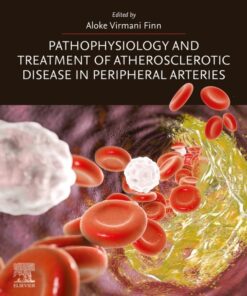 Pathophysiology and Treatment of Atherosclerotic Disease in Peripheral Arteries - 1st Edition