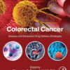 Colorectal Cancer