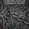 Retinal and Choroidal Vascular Diseases of the Eye - 1st Edition