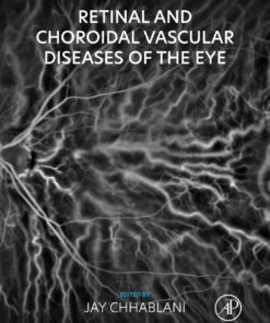 Retinal and Choroidal Vascular Diseases of the Eye - 1st Edition