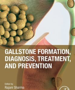 Gallstone Formation, Diagnosis, Treatment and Prevention - 1st Edition