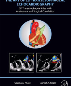 The Art of 2D Transesophageal Echocardiography - 1st Edition