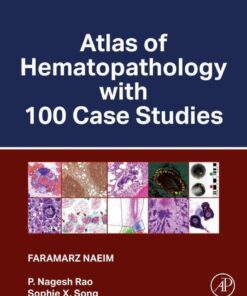 Atlas of Hematopathology with 100 Case Studies - 1st Edition