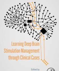 Learning Deep Brain Stimulation Management through Clinical Cases - 1st Edition