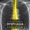Dysphagia - 1st Edition