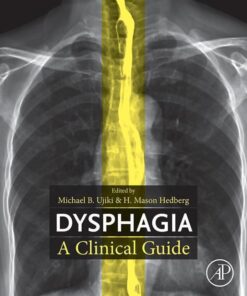 Dysphagia - 1st Edition