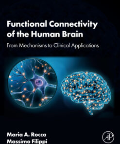 Functional Connectivity of the Human Brain