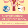 Complications of Hysteroscopy - 1st Edition