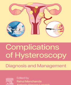 Complications of Hysteroscopy - 1st Edition