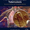 Pili in Mycobacterium Tuberculosis - 1st Edition