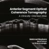 Anterior Segment Optical Coherence Tomography