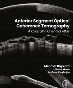 Anterior Segment Optical Coherence Tomography