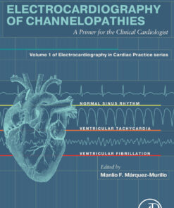 Electrocardiography of Channelopathies