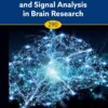Medical Image and Signal Analysis in Brain Research