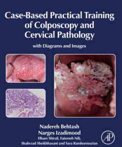 Case-Based Practical Training of Colposcopy and Cervical Pathology - 1st Edition