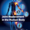 Joint Replacement in the Human Body - 1st Edition
