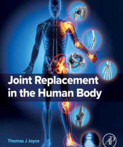 Joint Replacement in the Human Body - 1st Edition