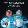 Eye Melanoma Unveiled