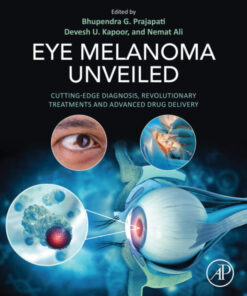 Eye Melanoma Unveiled