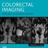 Colorectal Imaging